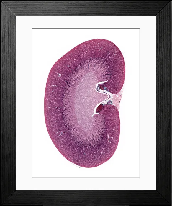 Framed Print : Longitudenal section of kidney microscope preparation Framed Print : Longitudenal section of kidney microscope preparation
