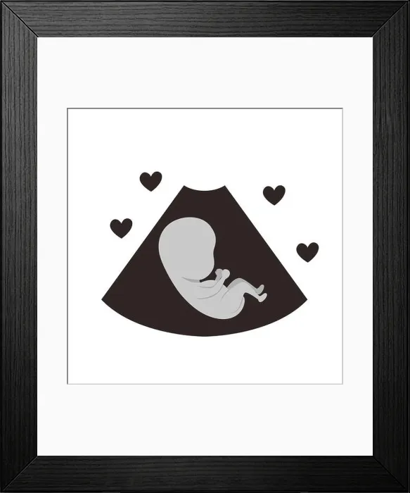 Framed Print : Isolated baby ultrasound design vector illustration Framed Print : Isolated baby ultrasound design vector illustration