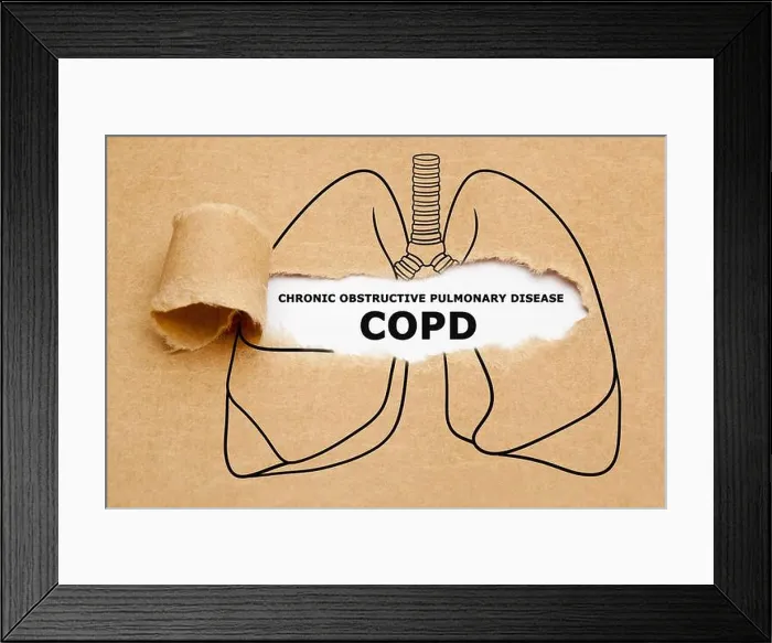 Framed Print : Text Chronic Obstructive Pulmonary Disease COPD appearing behind torn brown paper in human lungs drawing Framed Print : Text Chronic Obstructive Pulmonary Disease COPD appearing behind torn brown paper in human lungs drawing