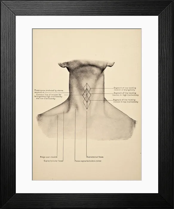 Framed Print : Illustration of the Human Neck copyright 1904 Framed Print : Illustration of the Human Neck copyright 1904