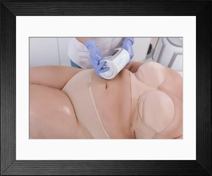 Framed Print : Cropped shot of plus size woman getting slimming hardware massage by cosmetologist Framed Print : Cropped shot of plus size woman getting slimming hardware massage by cosmetologist