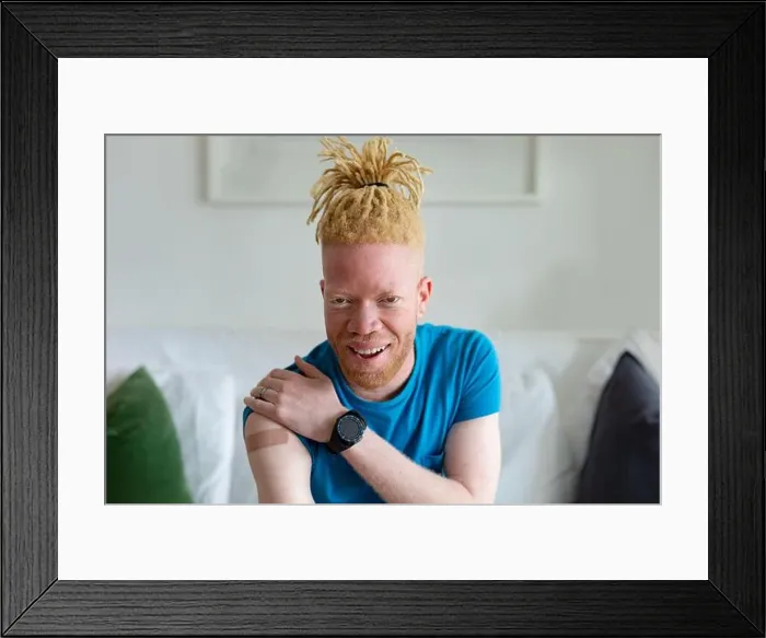 Framed Print : Happy african american albino man with plaster after vaccination Framed Print : Happy african american albino man with plaster after vaccination