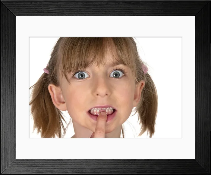 Framed Print : girl showing tooth gap Framed Print : girl showing tooth gap