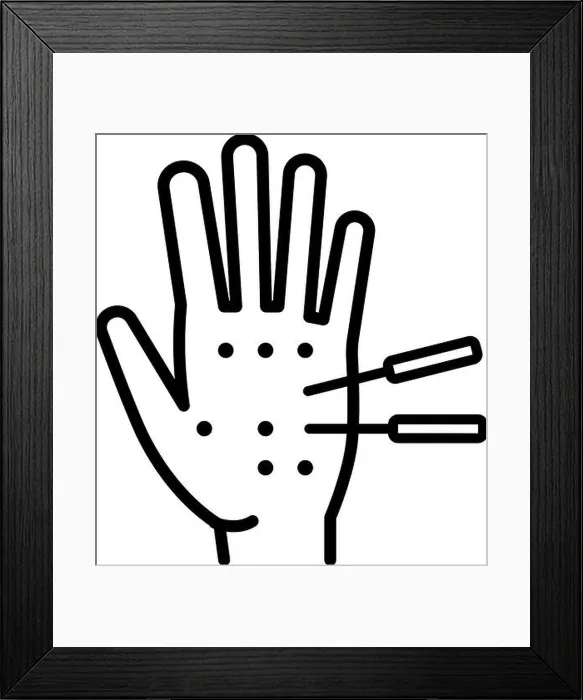 Framed Print : Acupuncture thin line icon. Hand with needle Framed Print : Acupuncture thin line icon. Hand with needle