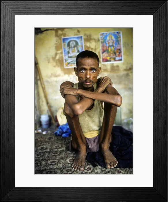 Framed Print : Portrait of an young man with Aids in his home in Mumbai, India Framed Print : Portrait of an young man with Aids in his home in Mumbai, India