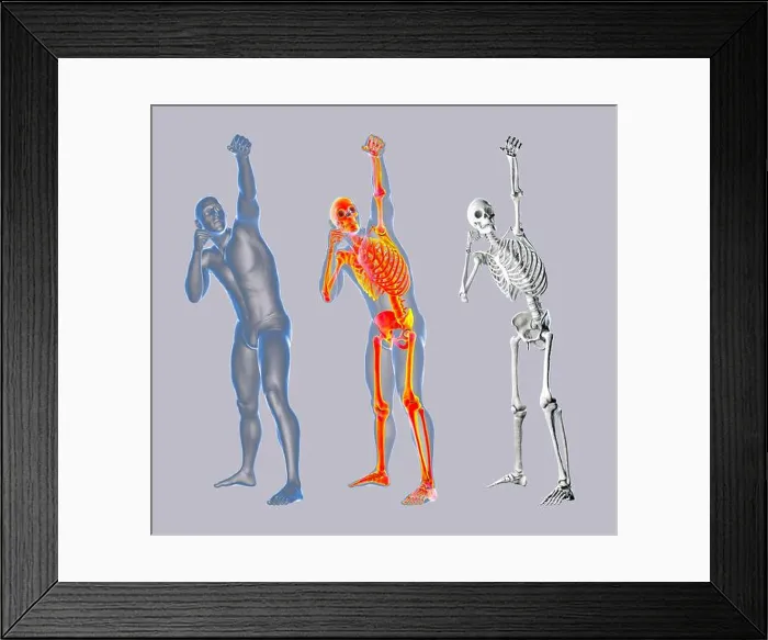 Framed Print : Anatomy of a boxer, illustration Framed Print : Anatomy of a boxer, illustration