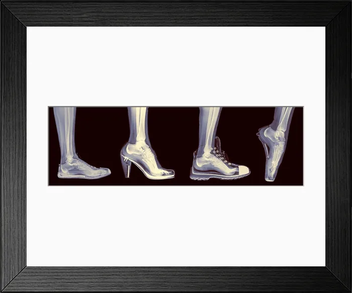 Framed Print : X-ray of a woman's foot in 4 different shoes (from left to right) Trainers, High Heel, Running and Ballet Framed Print : X-ray of a woman's foot in 4 different shoes (from left to right) Trainers, High Heel, Running and Ballet