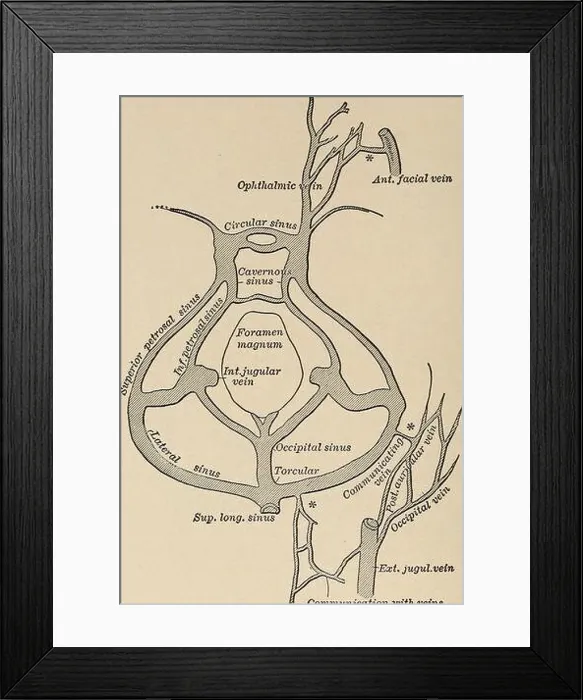Framed Print : Nervous and mental diseases. blood-current of this duralchannel