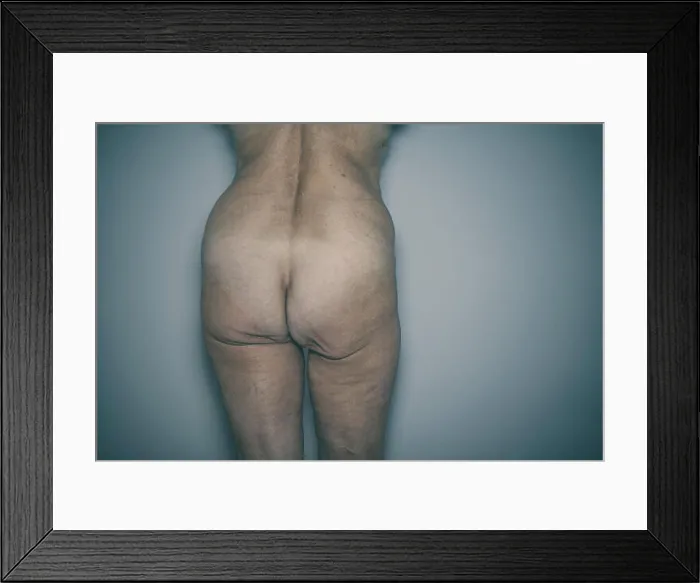Framed Print : old woman naked butt Framed Print : old woman naked butt