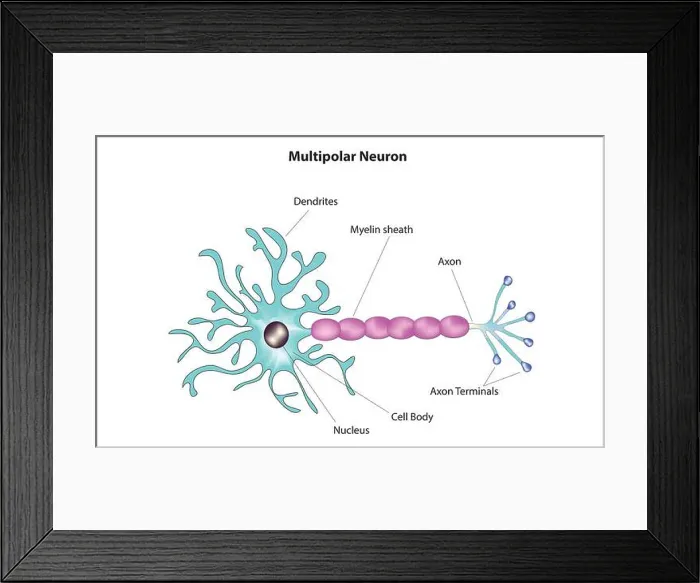 Framed Print : multipolar neuron Framed Print : multipolar neuron