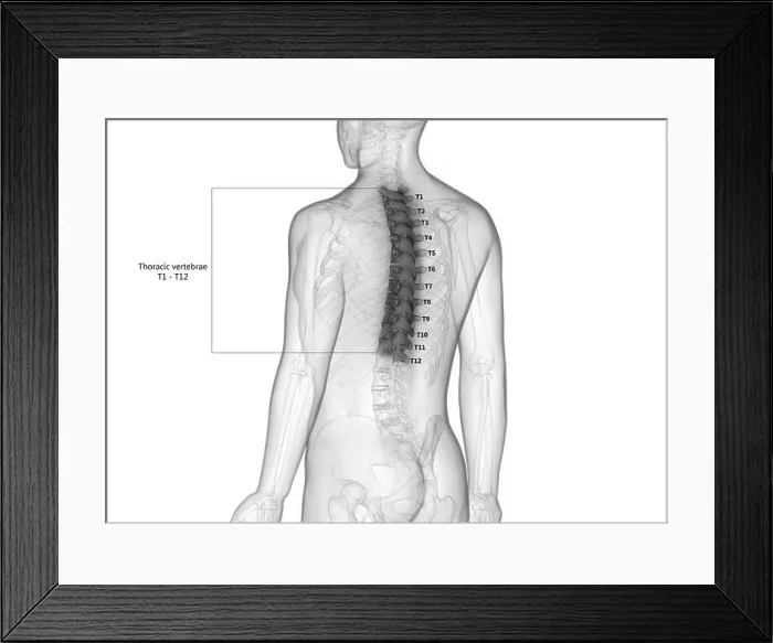 Framed Print : Vertebral Column Thoracic Vertebrae of Human Skeleton System with Detailed Labels Anatomy