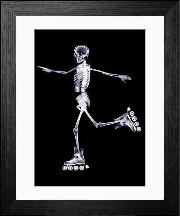 Framed Print : Skeleton in-line skating, X-ray Framed Print : Skeleton in-line skating, X-ray