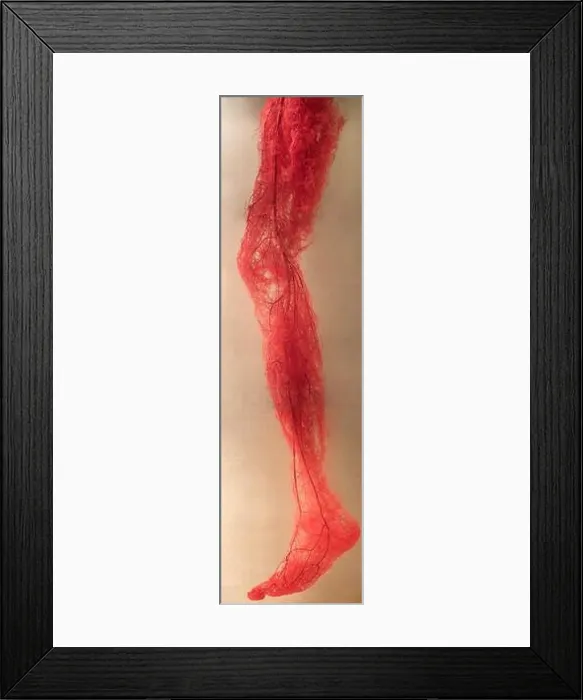 Framed Print : Blood Vessels of human leg Framed Print : Blood Vessels of human leg