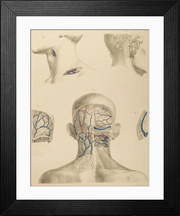 Framed Print : An anatomical illustration from Anton Nuhn's 1846 Surgical-Anatomical Tables Framed Print : An anatomical illustration from Anton Nuhn's 1846 Surgical-Anatomical Tables