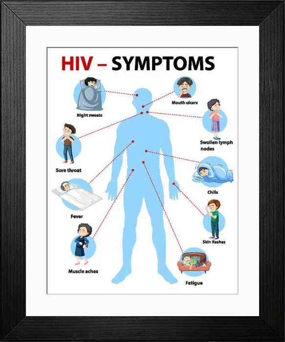 Framed Print : Symptoms of HIV infection infographic Framed Print : Symptoms of HIV infection infographic