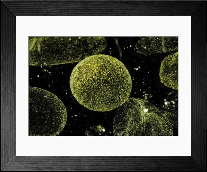 Framed Print : Phytoplankton Phaeocystis globosa Framed Print : Phytoplankton Phaeocystis globosa