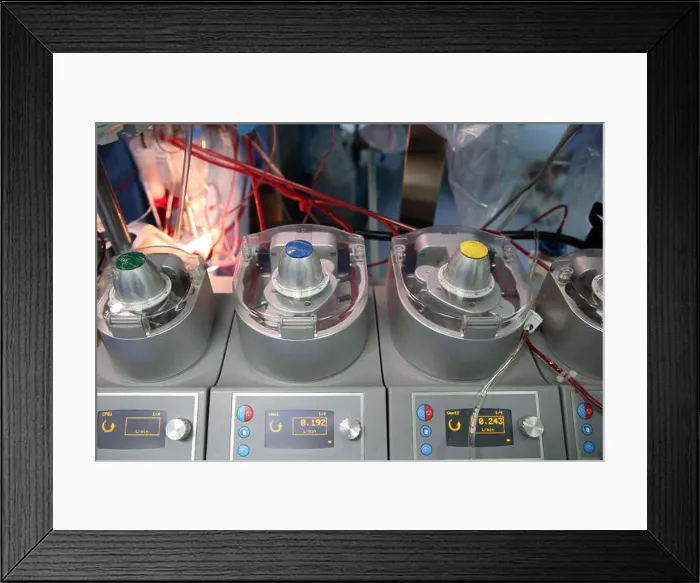 Framed Print : Operating theater. Cardiac surgery. Cardioplegia. Vietnam Framed Print : Operating theater. Cardiac surgery. Cardioplegia. Vietnam