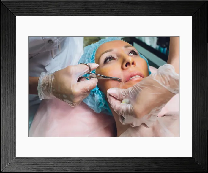 Framed Print : Close up of a hands threading beautiful womans upper lip Framed Print : Close up of a hands threading beautiful womans upper lip