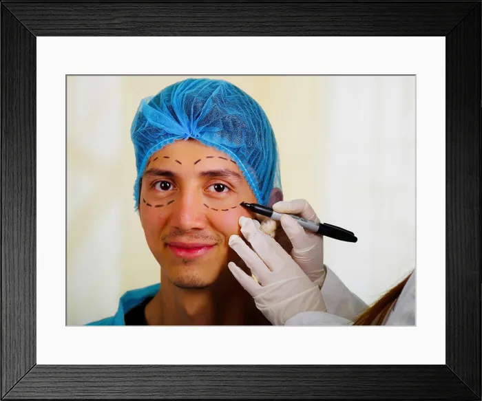 Framed Print : Surgeon drawing marks on male face. Plastic surgery concept Framed Print : Surgeon drawing marks on male face. Plastic surgery concept