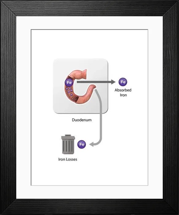 Framed Print : Iron metabolism. from liver, intestine and spleen Framed Print : Iron metabolism. from liver, intestine and spleen