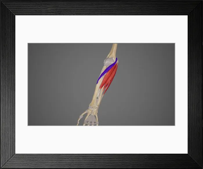 Framed Print : Forearm Muscles-Pronator Teres Illustration Framed Print : Forearm Muscles-Pronator Teres Illustration