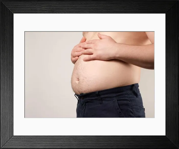 Framed Print : A man with a big sagging stomach, the concept of excess weight in men, a place for text Framed Print : A man with a big sagging stomach, the concept of excess weight in men, a place for text