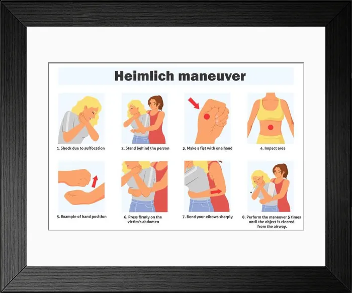 Framed Print : Heimlich maneuver infographic poster with steps of first aid Framed Print : Heimlich maneuver infographic poster with steps of first aid