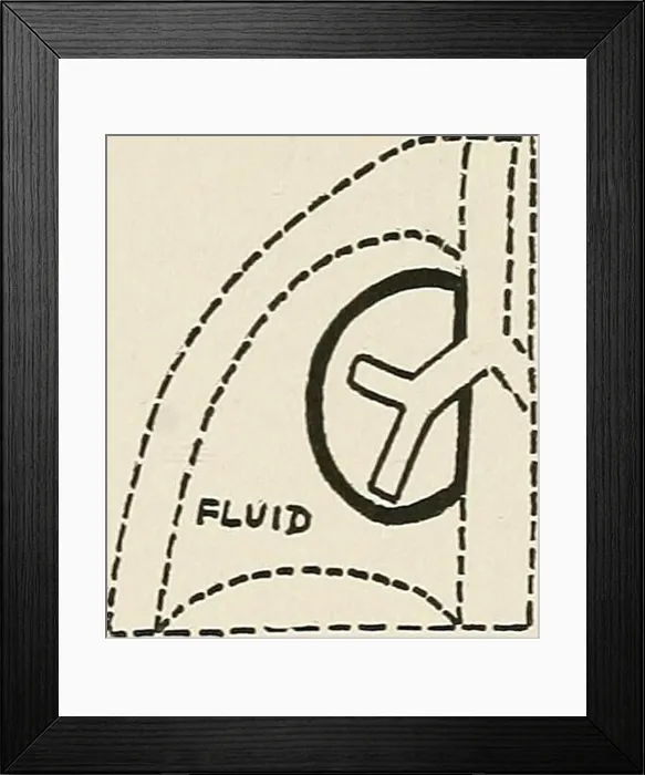 Framed Print : Diseases of the chest and the principles of physical diagnosis Framed Print : Diseases of the chest and the principles of physical diagnosis