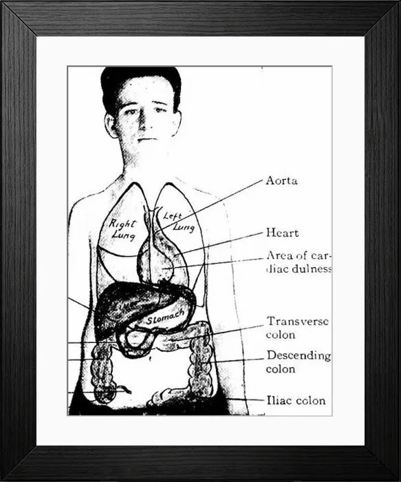 Framed Print : A manual of anatomy. right and left inguinal regions; D Framed Print : A manual of anatomy. right and left inguinal regions; D