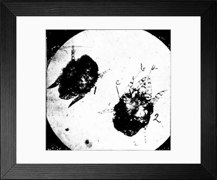 Framed Print : Animal parasites and parasitic diseases Framed Print : Animal parasites and parasitic diseases
