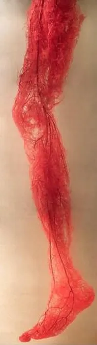 Framed Print : Blood Vessels of human leg Framed Print : Blood Vessels of human leg