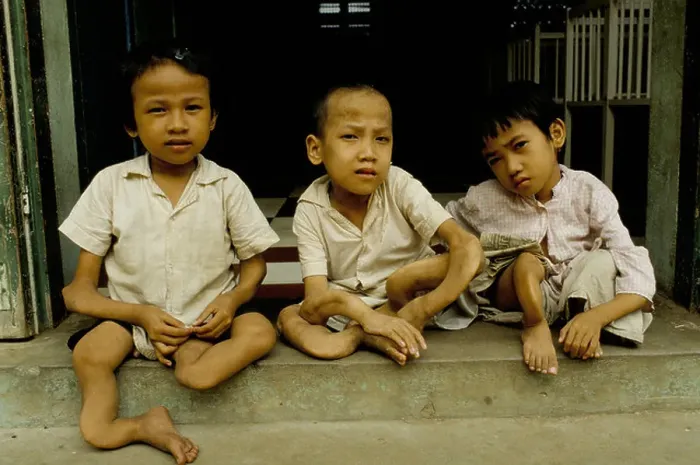 Framed Print : These brothers and sisters born with limb deformities were found abandoned in a plantation regularly sprayed with Agent Framed Print : These brothers and sisters born with limb deformities were found abandoned in a plantation regularly sprayed with Agent