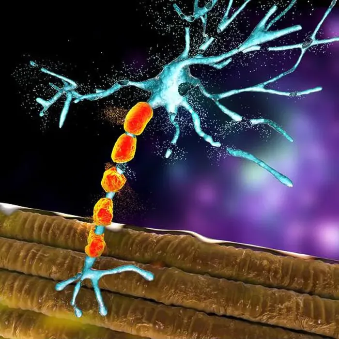 Framed Print : Degradation of motor neurons, conceptual computer illustration Framed Print : Degradation of motor neurons, conceptual computer illustration