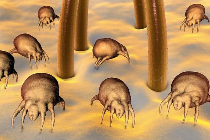 Framed Print : Dust mites (Dermatophagoides pteronyssinus) on human skin Framed Print : Dust mites (Dermatophagoides pteronyssinus) on human skin