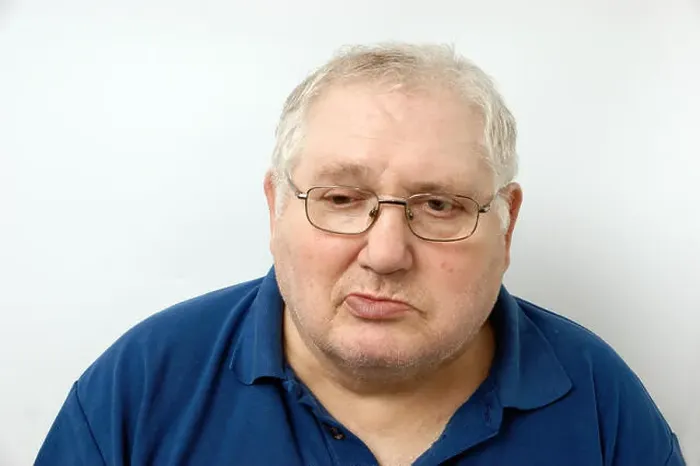 Framed Print : Elderly man suffering from Bell's Palsy Bell's palsy is a form of facial paralysis resulting from a dysfunction of Framed Print : Elderly man suffering from Bell's Palsy Bell's palsy is a form of facial paralysis resulting from a dysfunction of