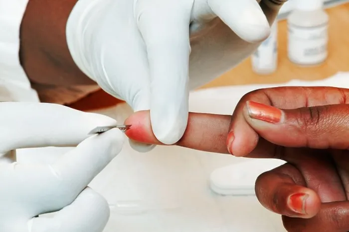 Framed Print : Finger pricked for HIV testing Johannesburg Gauteng Province South Africa Framed Print : Finger pricked for HIV testing Johannesburg Gauteng Province South Africa