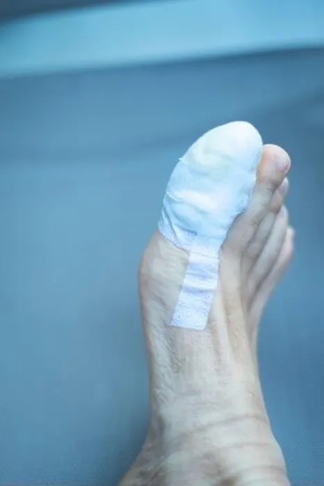 Framed Print : Foot big toe bandage injured feet in medical clinic hospital center Framed Print : Foot big toe bandage injured feet in medical clinic hospital center