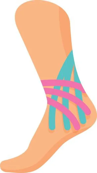 Framed Print : Foot kinesio tape icon cartoon vector. Muscle tape. Sport support