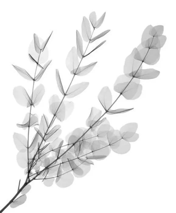 Framed Print : Gum tree (Eucalyptus cinerea), X-ray Framed Print : Gum tree (Eucalyptus cinerea), X-ray