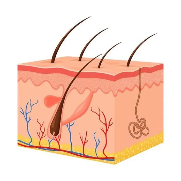 Framed Print : Human skin. Layered epidermis with hair follicle Framed Print : Human skin. Layered epidermis with hair follicle