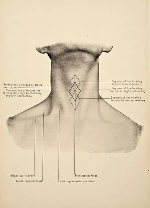Framed Print : Illustration of the Human Neck copyright 1904 Framed Print : Illustration of the Human Neck copyright 1904