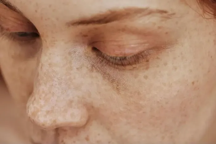 Framed Print : Macro shot of face with freckles of young natural woman with no-makeup on her eyes Framed Print : Macro shot of face with freckles of young natural woman with no-makeup on her eyes
