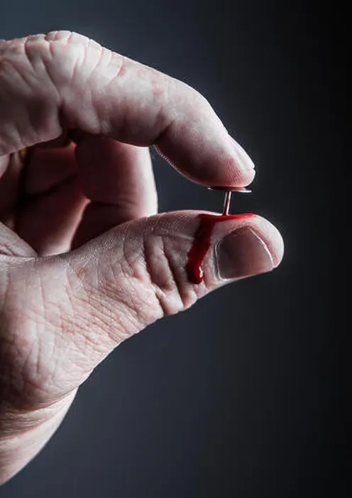 Framed Print : A man's hand pressing a thumbtack into his thumb