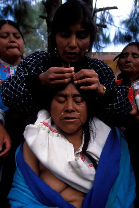 Framed Print : Mexico, San Cristobal de las Casas. Mayan Indian woman having acupuncture treatment for ailments Framed Print : Mexico, San Cristobal de las Casas. Mayan Indian woman having acupuncture treatment for ailments