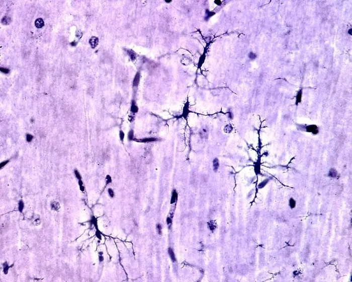 Framed Print : Microglia cells stained with Rio Hortega's silver carbonate method in the grey matter of the brain. This type is the ramified or resting microglia Framed Print : Microglia cells stained with Rio Hortega's silver carbonate method in the grey matter of the brain. This type is the ramified or resting microglia