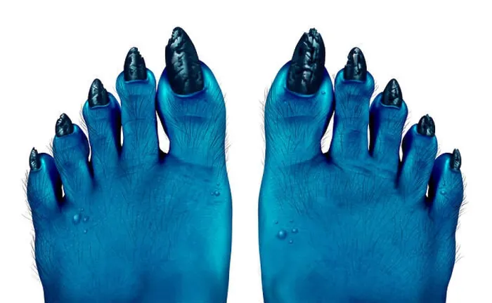 Framed Print : Monster blue feet as a creepy halloween or scary zombie symbol with textured skin and toes with hair Framed Print : Monster blue feet as a creepy halloween or scary zombie symbol with textured skin and toes with hair