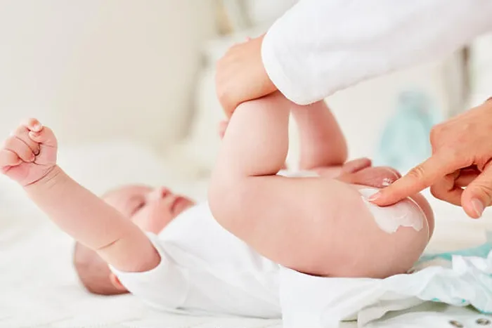 Framed Print : Mother creams the buttocks of an infant as a precaution against intertrigo Framed Print : Mother creams the buttocks of an infant as a precaution against intertrigo
