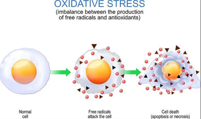 Framed Print : Oxidative stress. imbalance between the production of free radicals and antioxidants Framed Print : Oxidative stress. imbalance between the production of free radicals and antioxidants