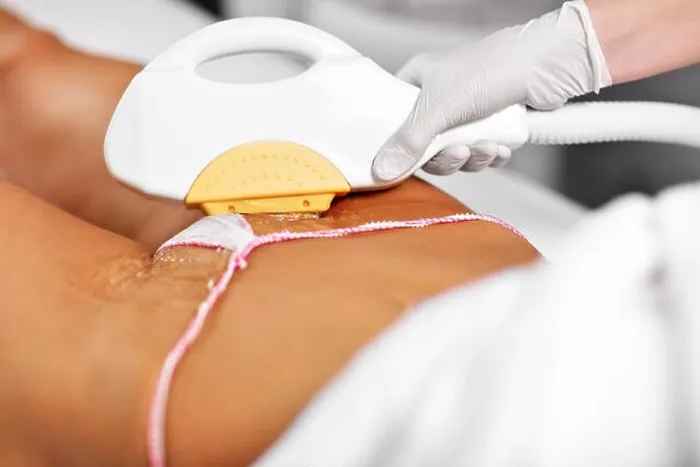 Framed Print : Picture Of Beautician Giving Epilation Laser Treatment To Woman On Bikini Framed Print : Picture Of Beautician Giving Epilation Laser Treatment To Woman On Bikini