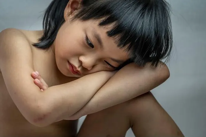 Framed Print : Portrait of poor despair little child girl, sitting without clothes, bruised on body, close up shot to emotional face Framed Print : Portrait of poor despair little child girl, sitting without clothes, bruised on body, close up shot to emotional face